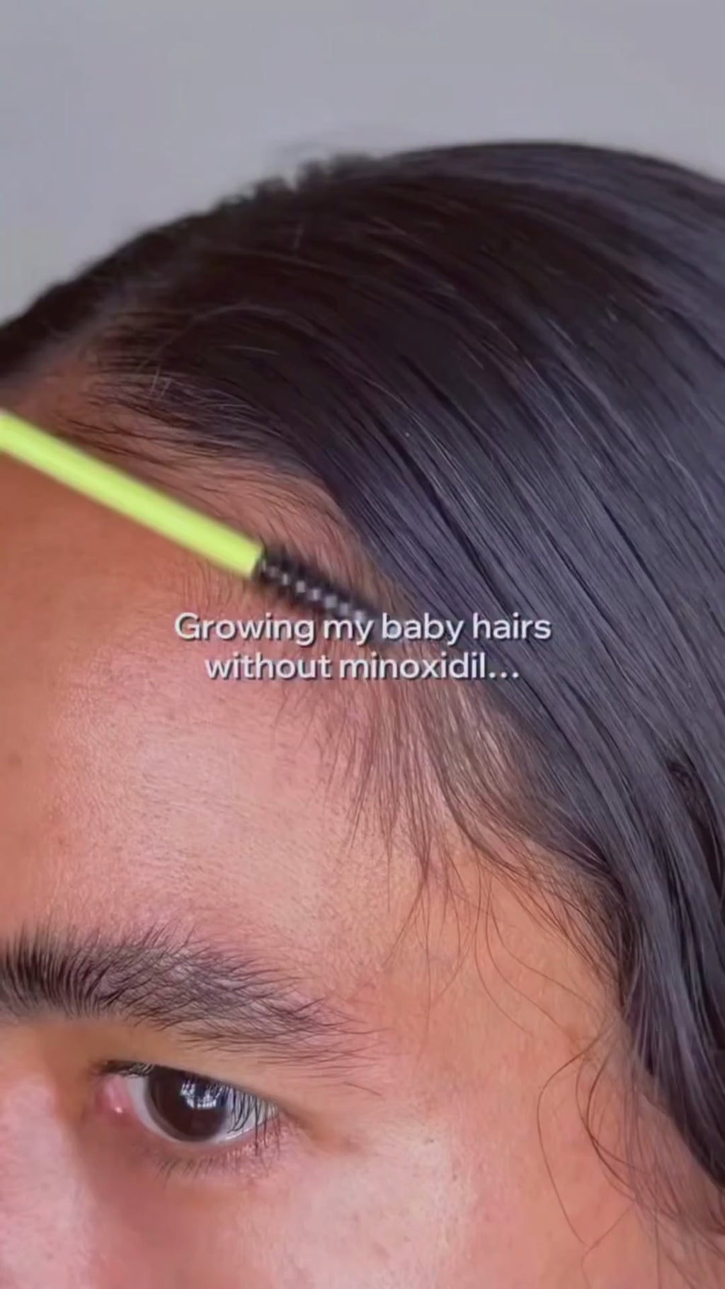 Rosemary Pdrn Antihairfall Serum