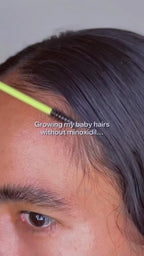 Rosemary Pdrn Antihairfall Serum